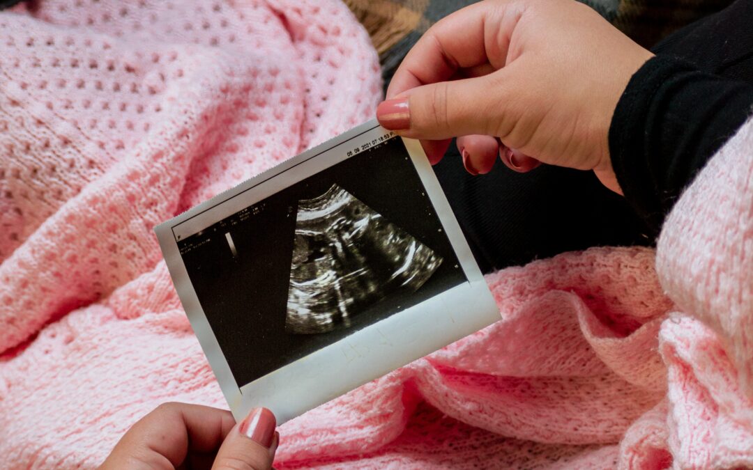 Woman looking at picture of sonogram.